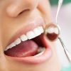 Oral and Dental Diseases