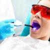 Dental Laser Treatment