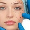 Eyelid Surgery