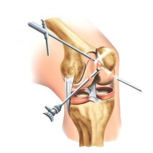 Orthopaedics - Traumatology