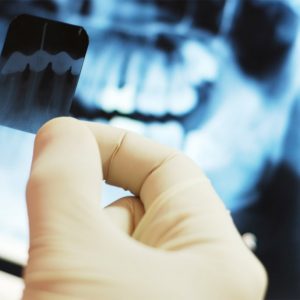 Oral Diagnosis and Radiology