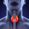 Thyroid Cancer