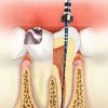 Conservative Dentistry and Endodontics