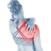 Shoulder Pain