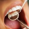 PERIODONTOLOGY (GUM DISEASES)
