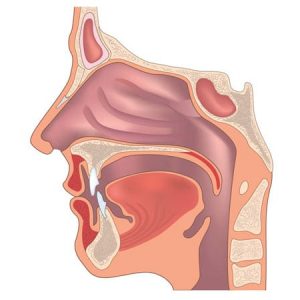 Ear, nose and throat
