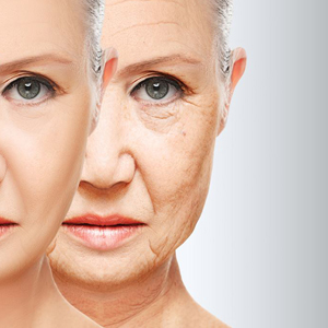 Anti-aging therapy